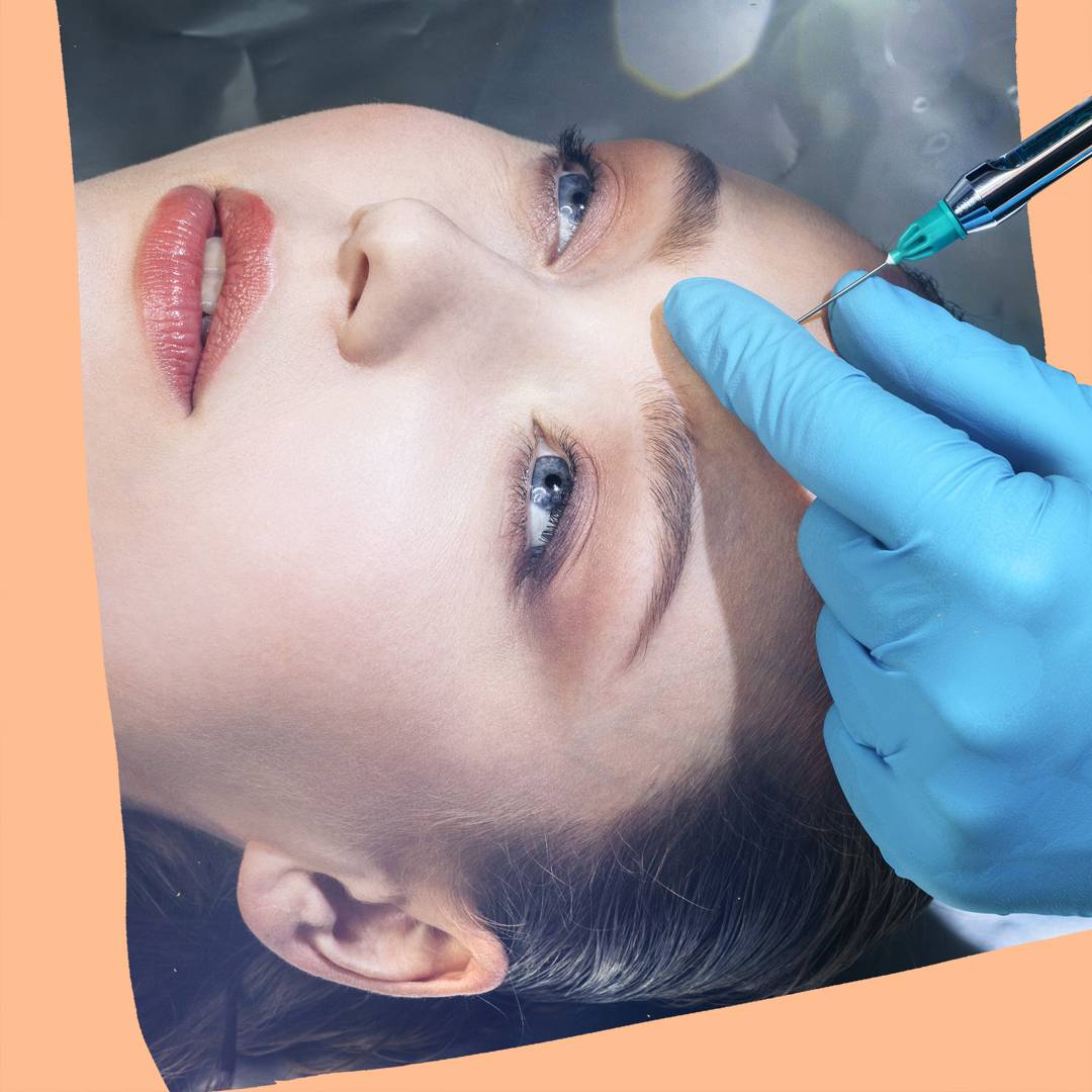 Image: Everything the experts want you to know about Botox if you're thinking of trying it after lockdown