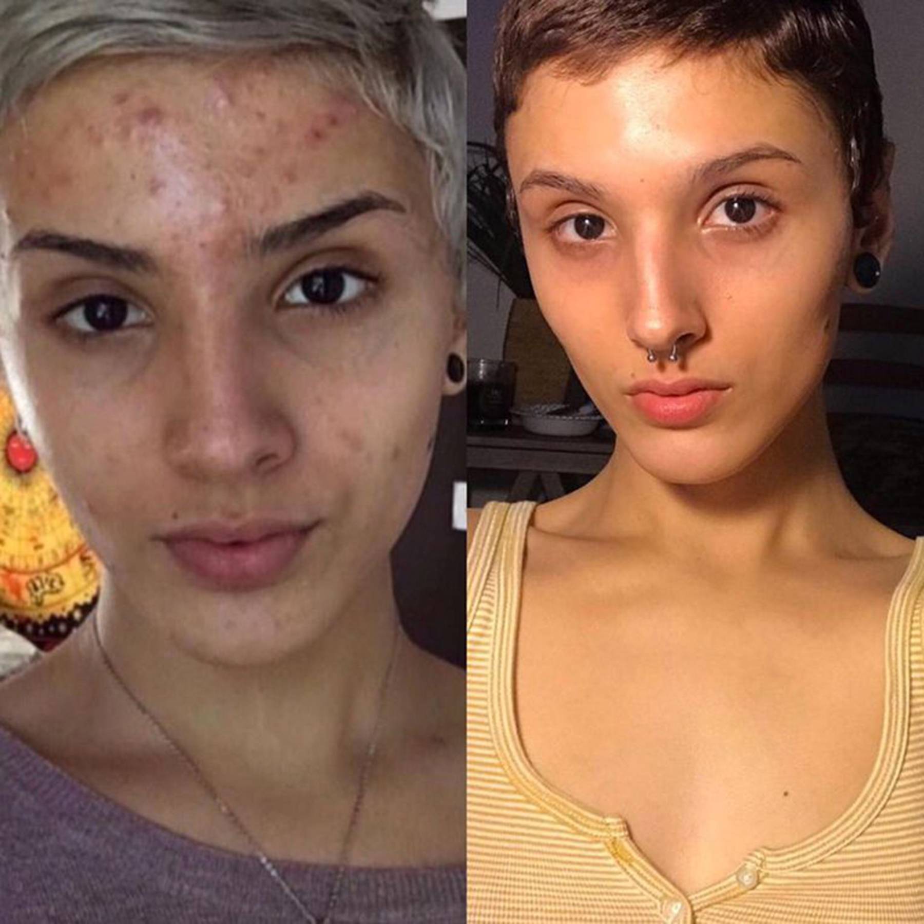 what does retinol do