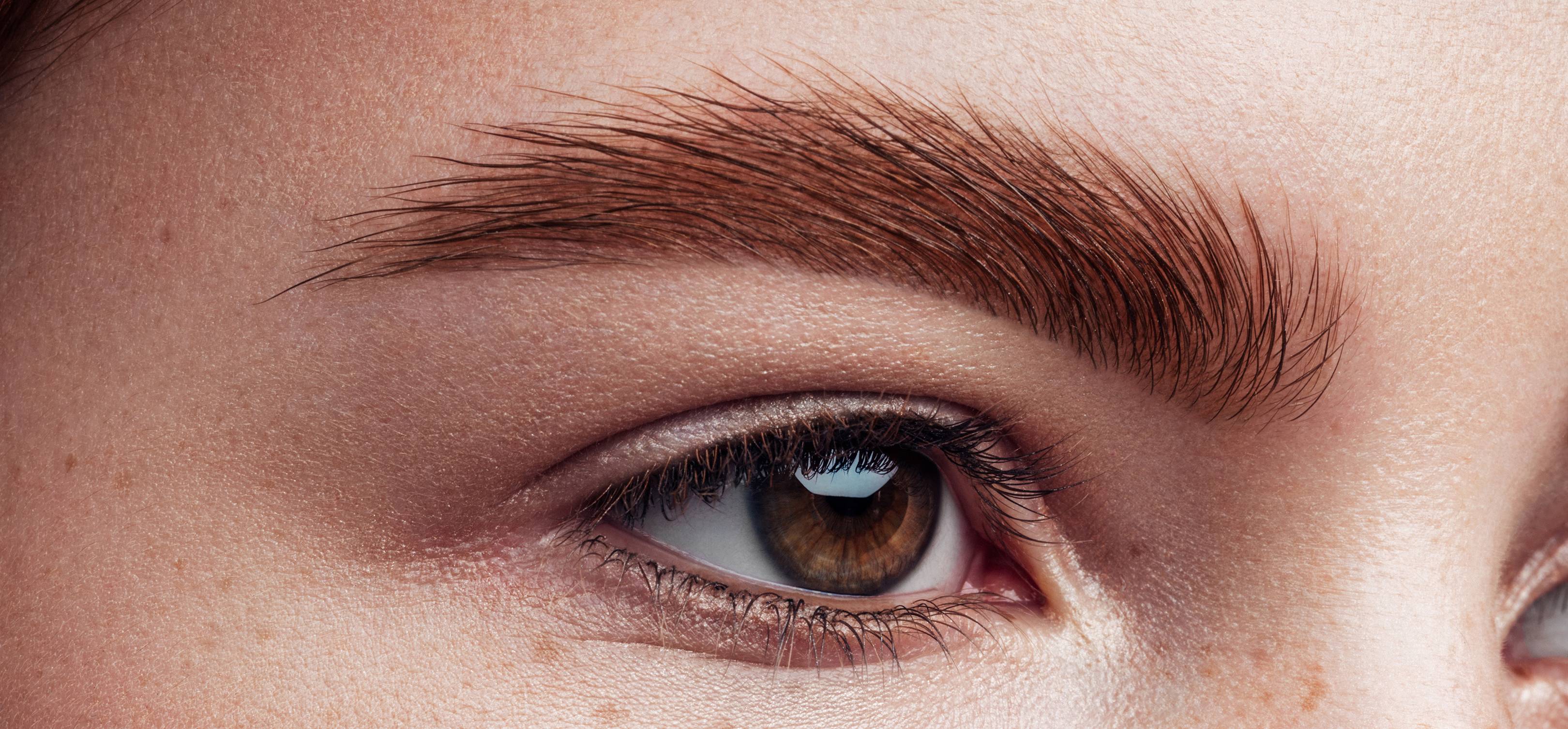 How To Tell If You Have Eyebrow Dandruff And How To Get Rid Of It