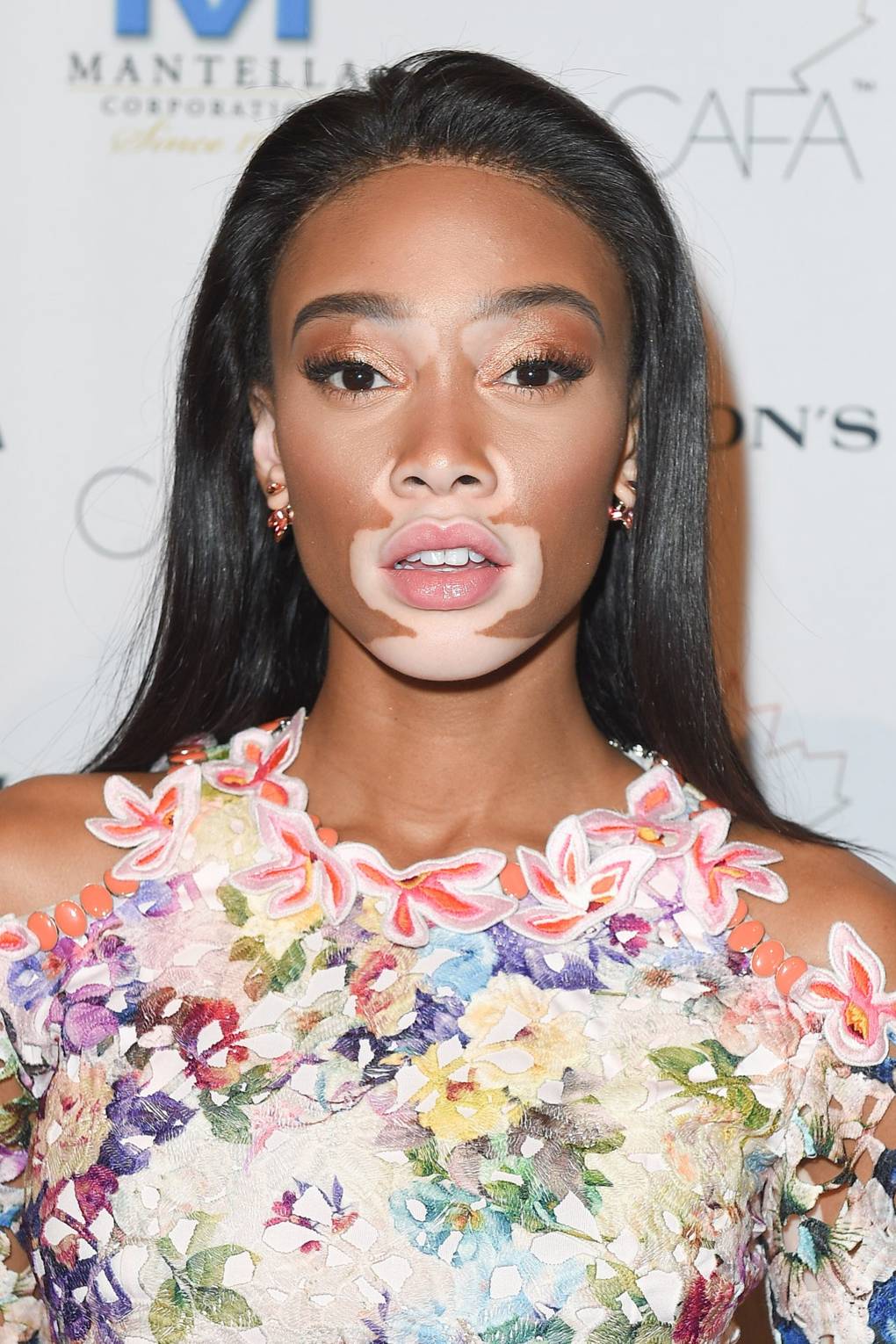 Winnie Harlow hair - best celebrity hairstyles & beauty 2017 | Glamour UK