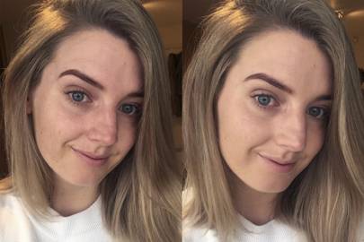 Glossier Perfecting Skin Tint Review Unfiltered Before And After Pictures Of The New Formula Glamour Uk