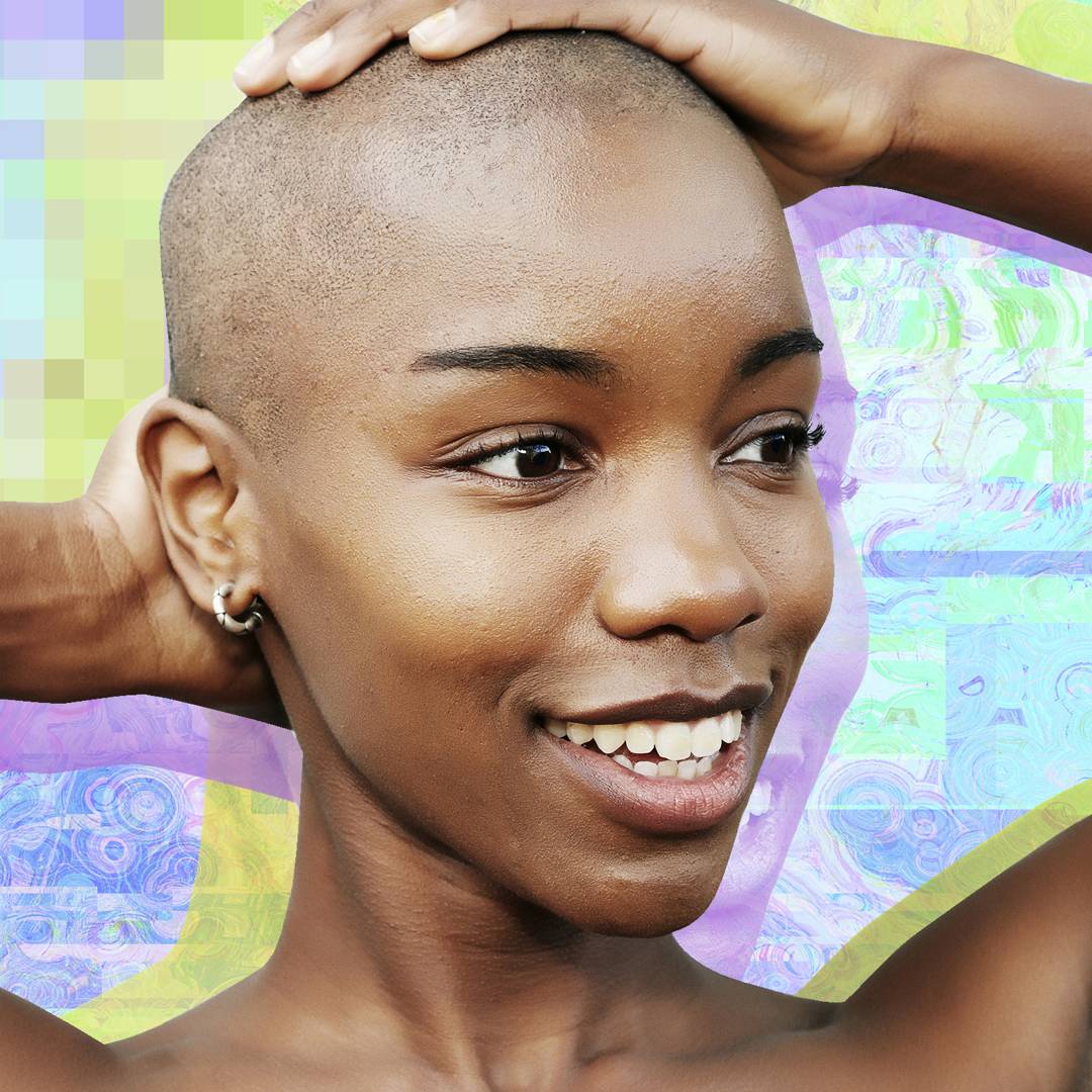 Image: How black women are conquering alopecia and coming to terms with what a lack of hair means for their identity