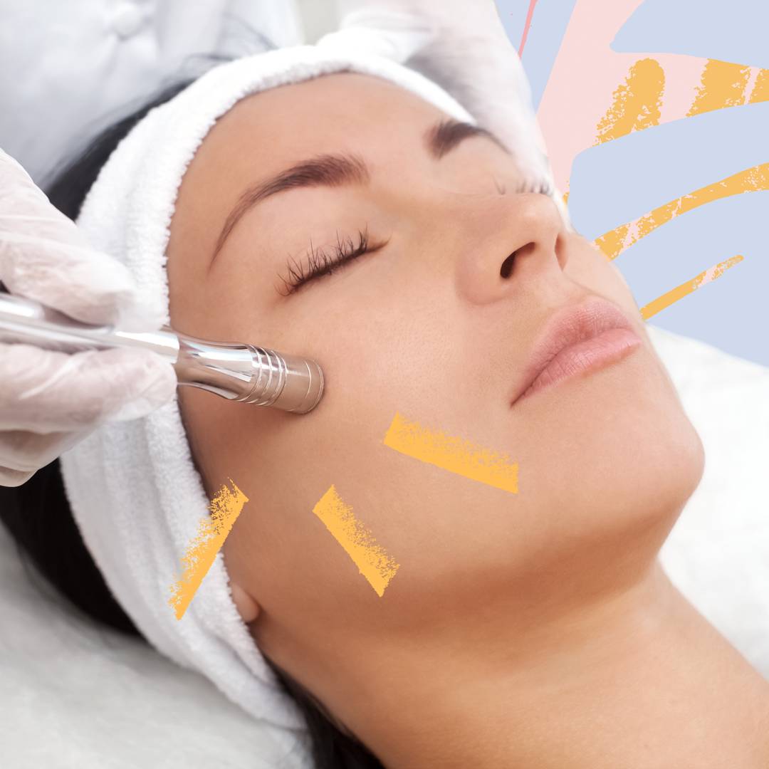 Image: Here's why microdermabrasion could be the answer to your post-lockdown skin problems