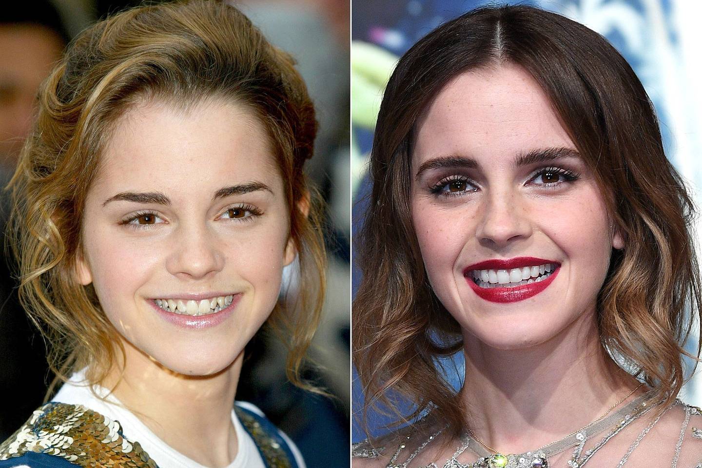 Celebrity Teeth Before And After Teeth Whitening Makeovers Pictures 2017 Glamour Uk 7595