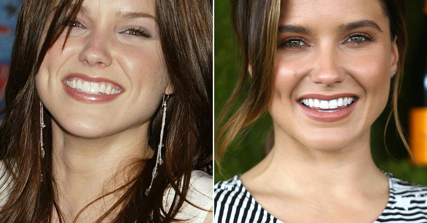 Celebrity Teeth Before & After: Teeth Whitening Makeovers Pictures 2017