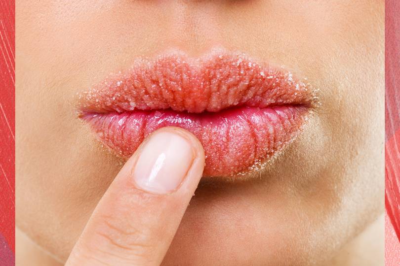 7-tips-to-make-a-lip-pimple-disappear-quickly-business-insider-india