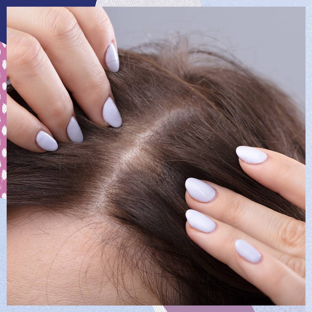 Image: Skincare is coming for your scalp - hereâs how to give it the TLC it deserves