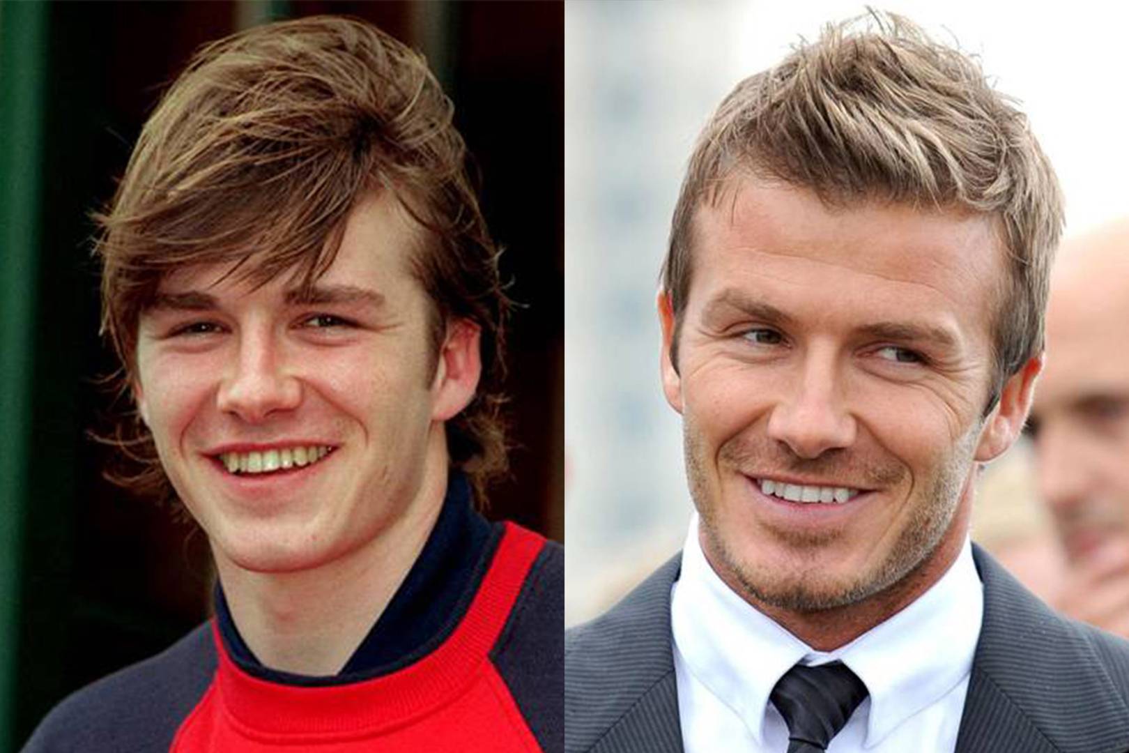 Celebrity Teeth Before & After: Dental Whitening Makeovers | Glamour UK