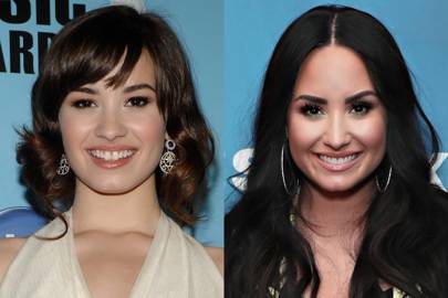 Demi lovato gap teeth before and after