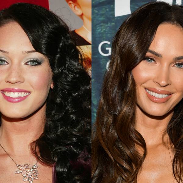 Celebrity Teeth Before & After: Dental Whitening Makeovers ...