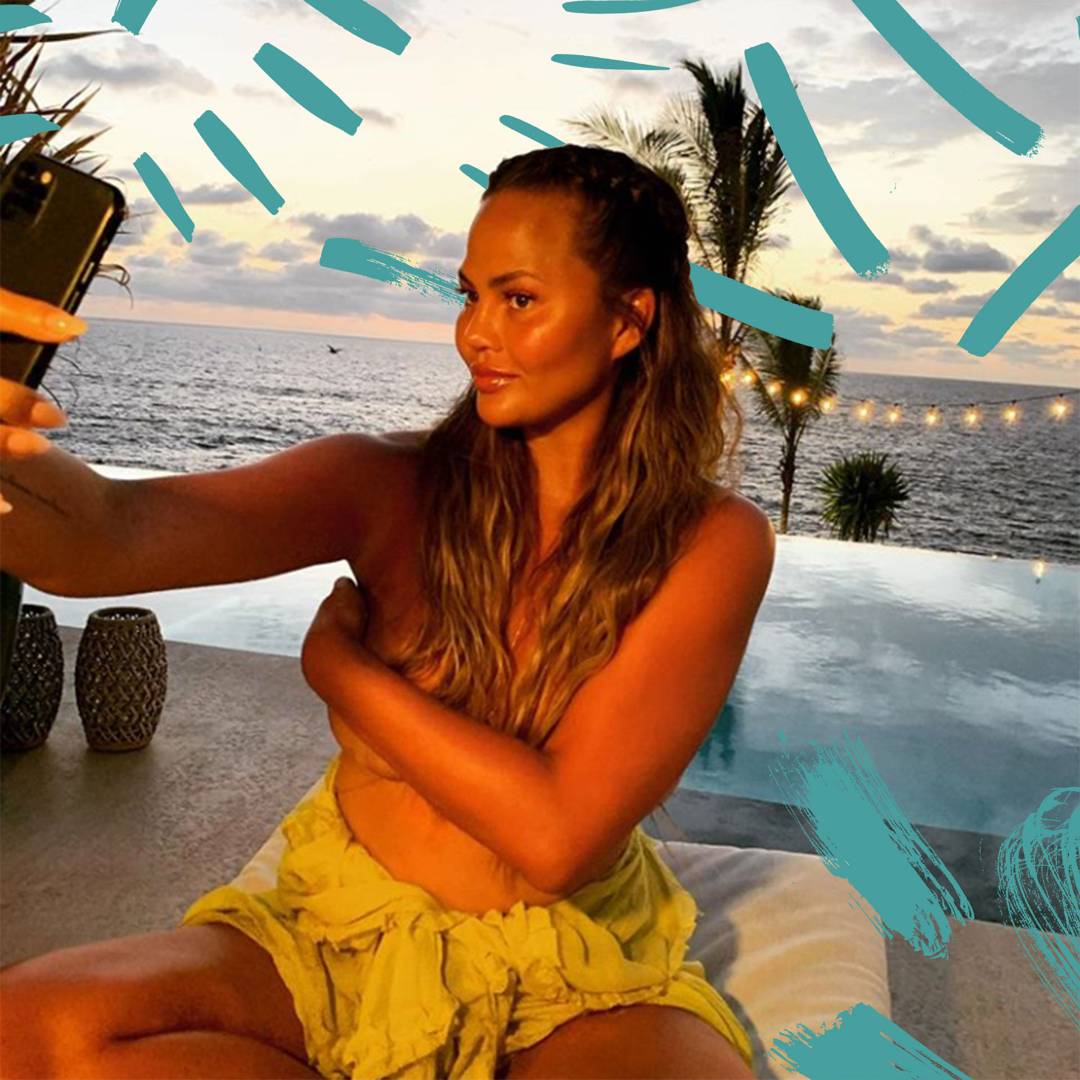 Image: This is why Chrissy Teigen is getting Botox during pregnancy