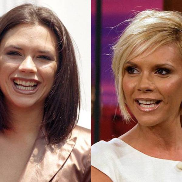 Celebrity Teeth Before & After: Dental Whitening Makeovers | Glamour UK