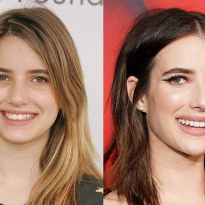 Celebrity Teeth Before & After: Dental Whitening Makeovers | Glamour UK