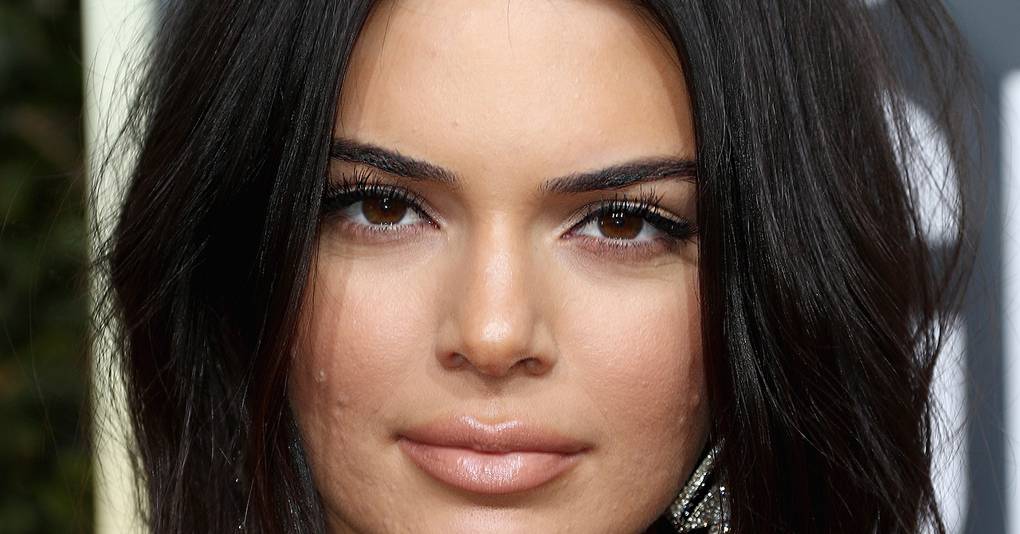 Kendall Jenner Acne: She Gets Real About Dealing With Spots | Glamour UK