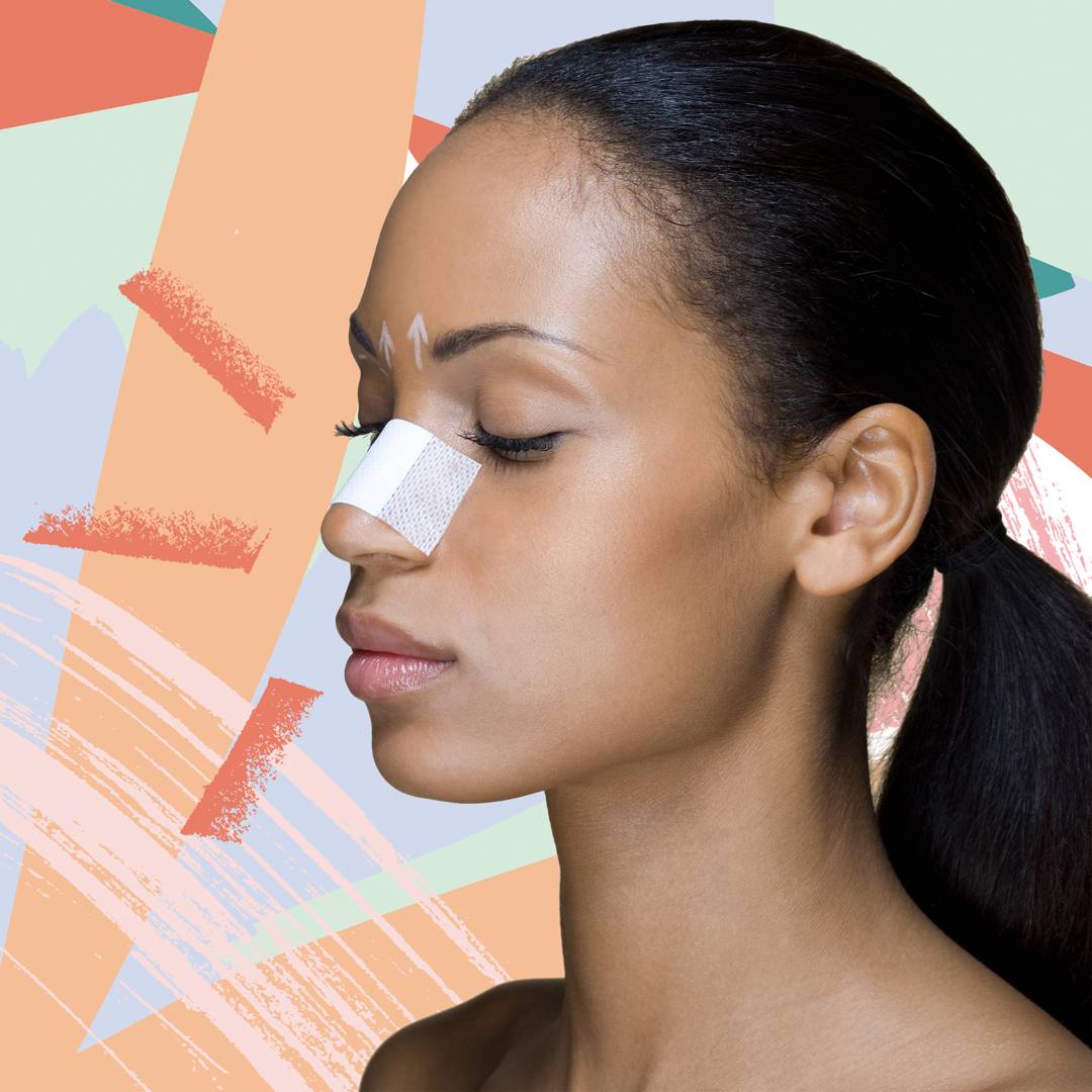 Image: A surgeon explains everything you need to know about non-surgical nose jobs