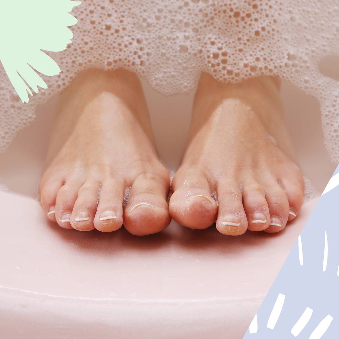 Image: Here's exactly how to get rid of pesky dry skin on your feet