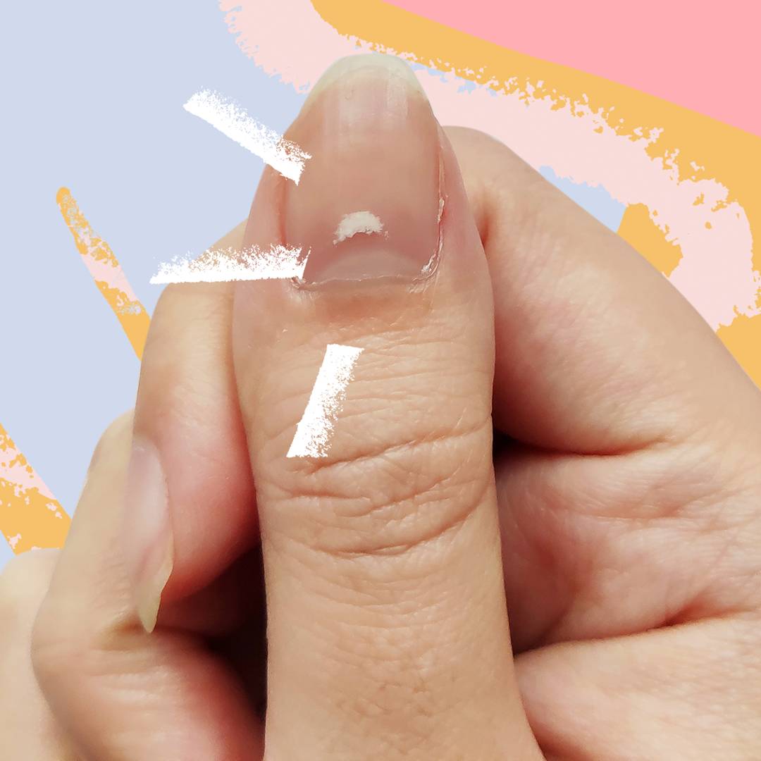 Image: What white spots on your nails actually mean - and how to avoid them