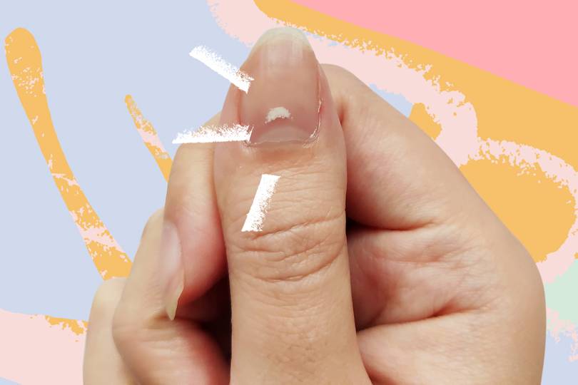 how-to-get-rid-of-white-spots-on-nails-homemade-health-remedies